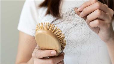 sugary drinks hair loss