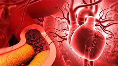 statin cholesterol heart disease