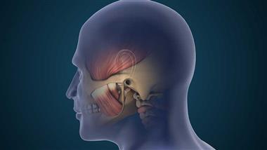 temporomandibular joint tmj pain butyrate