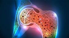 serotonin osteoporosis