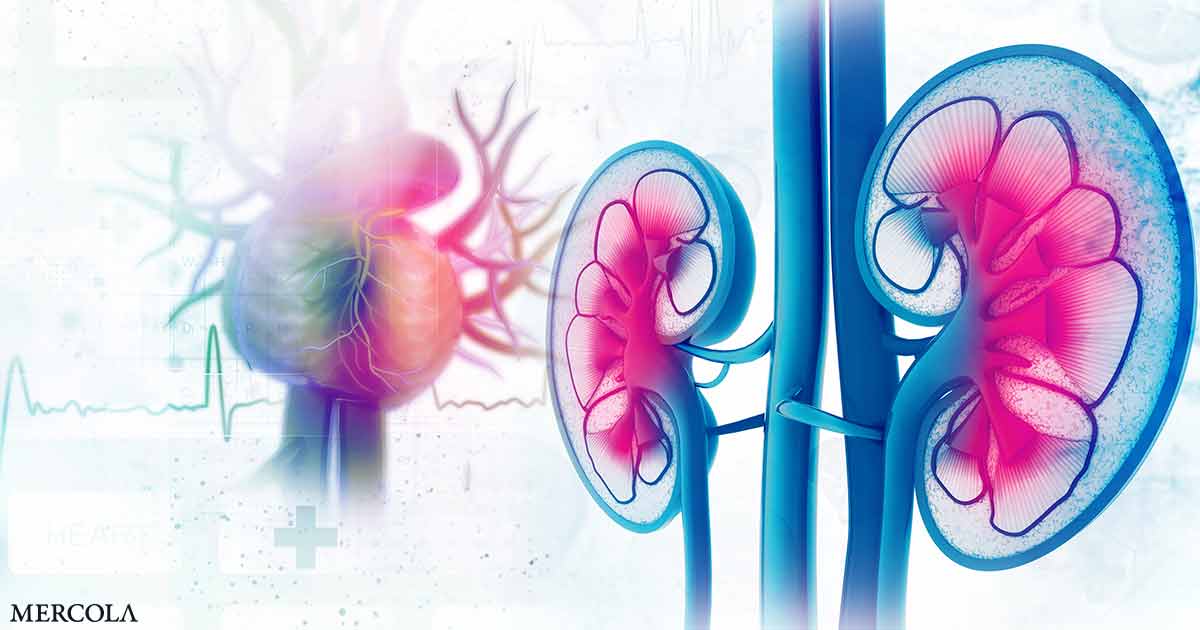 Why Chronic Kidney Disease So Often Ends in Heart Problems