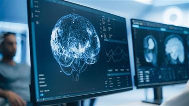 neurological disorders america statistics