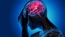 iron overload stroke related injury