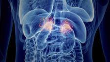 adrenal fatigue exhaustion