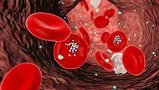 microplastics arterial plaque