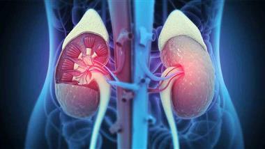 advanced cardiovascular kidney metabolic disease