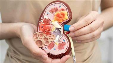 chronic kidney disease heart health