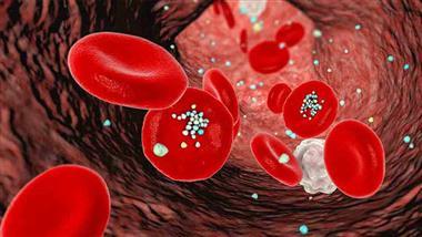 microplastics arterial plaque