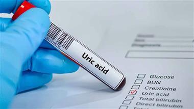 molecular hydrogen uric acid