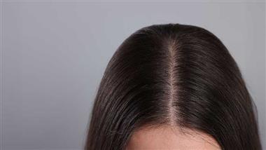 scalp microbiome
