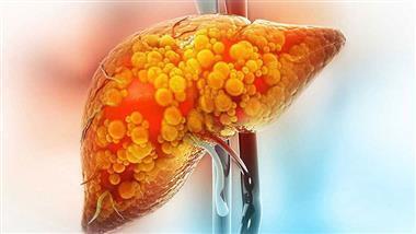 krill oil fatty liver oxidative stress obesity