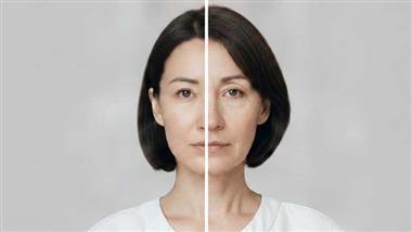 ozempic face causes and prevention
