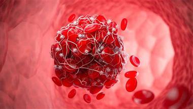 nattokinase blood thinning
