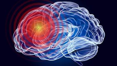 stroke speech comprehension