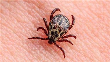 tick saliva immune suppression lyme disease