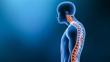 curved back kyphosis