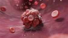 Blockbuster Anticlotting Drug Approved on Flawed Studies