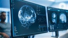 neurological disorders america statistics