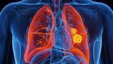 lung cancer indoor air risks