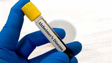 alzheimers blood test