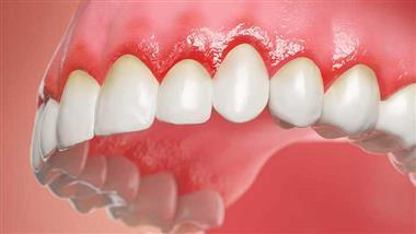 gum disease systemic inflammation diabetes