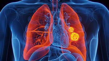 lung cancer indoor air risks