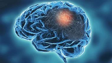 probiotics alzheimers neurodegenerative diseases