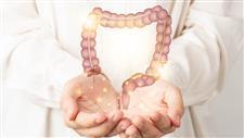 treating sibo holistically