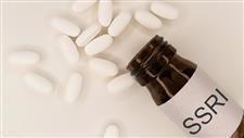 ssri antidepressant side effects