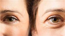 younger adults aging faster raising cancer risk