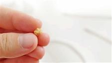 how to prevent tonsil stones from coming back