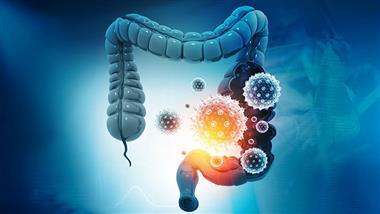 vitamin d helps lower risk of colorectal cancer