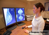 3D Mammogram (Tomosynthesis)