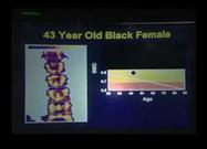 Entertaining Expert Lecture on Vitamin D