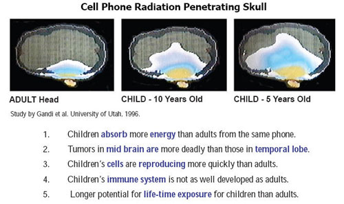 Cell Phone Radiation Child brain