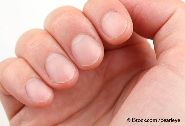 10 nail symptoms