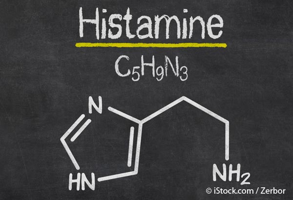 is histamine to blame for headache hives heartburn