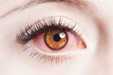 can eyes reveal health problems