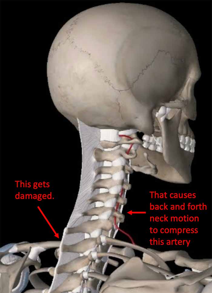 back spine