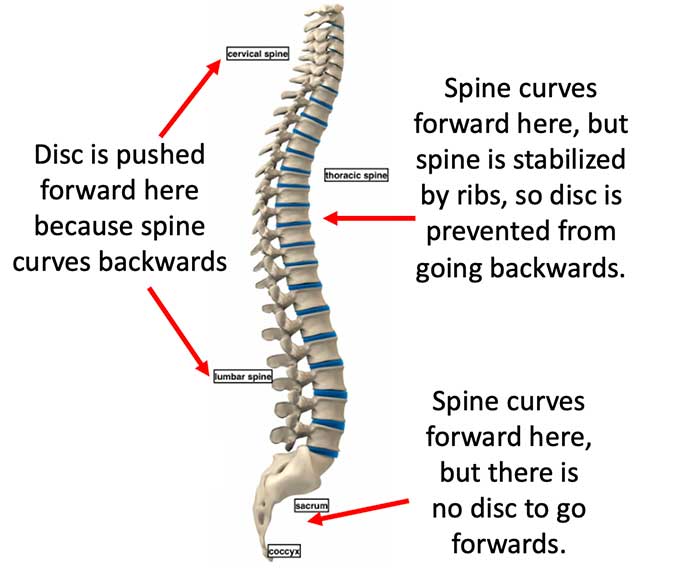 spinal curvature disc backwards