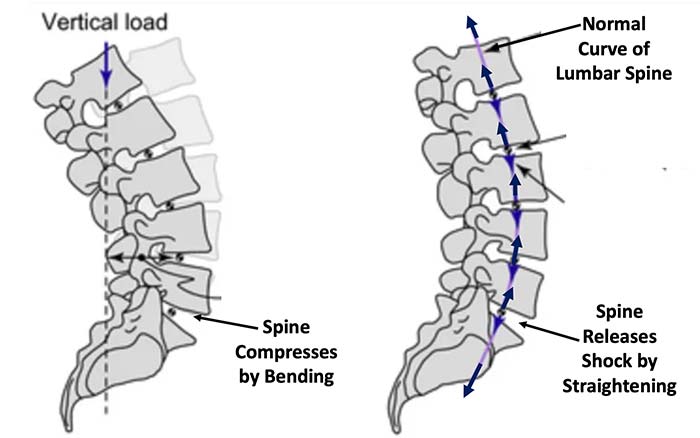 spinal curvature