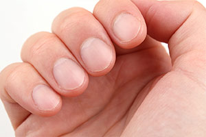 Симптомы на ногтях