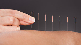 Les bienfaits de l’acupuncture