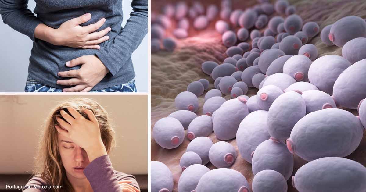 Como a Candida Albicans Pode Afetar Sua Saúde
