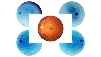 anatomia do olho humano