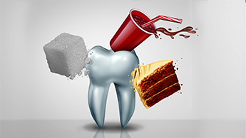 미백제와 탄산음료로 인한 치아 손상