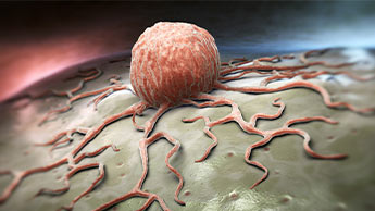 cellule cancéreuse