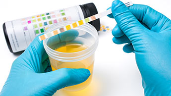Test delle urine per migliorare la salute