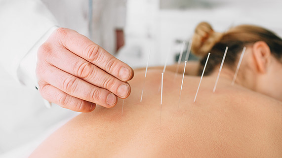 acupuncture traitement