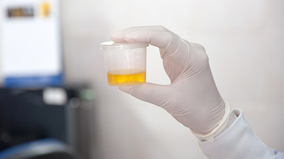 échantillon d’urine